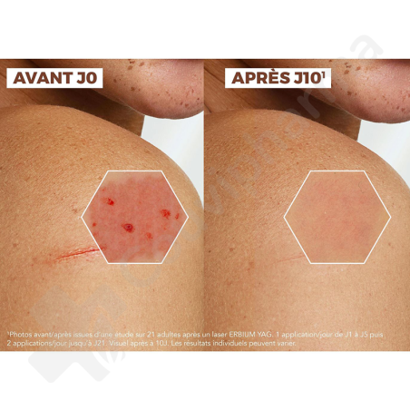 A-Derma Epithéliale Ultra Repair - Crème 40 ml