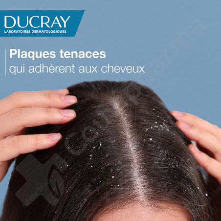 Ducray Squanorm Verzorgende Shampoo Vette Schilfers - 200 ml